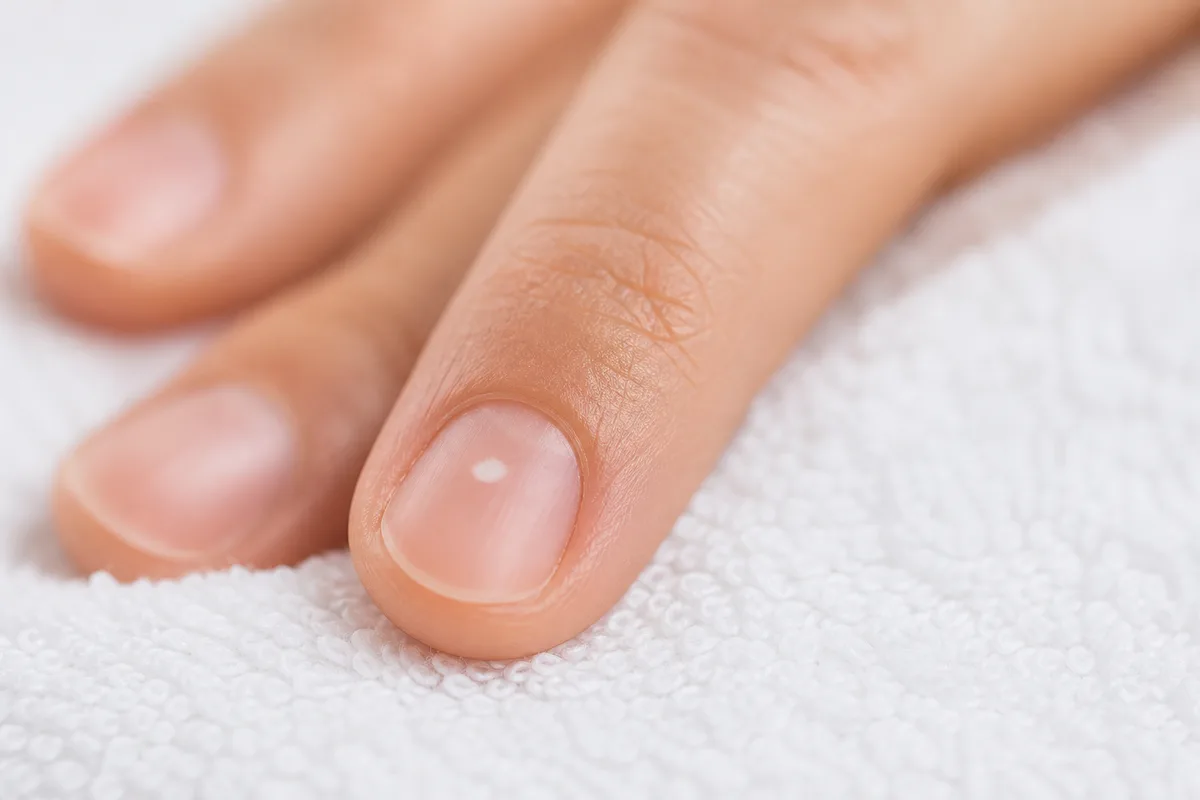 Main féminine posée sur un linge clair, gros plan sur un ongle naturel portant une petite tache blanche